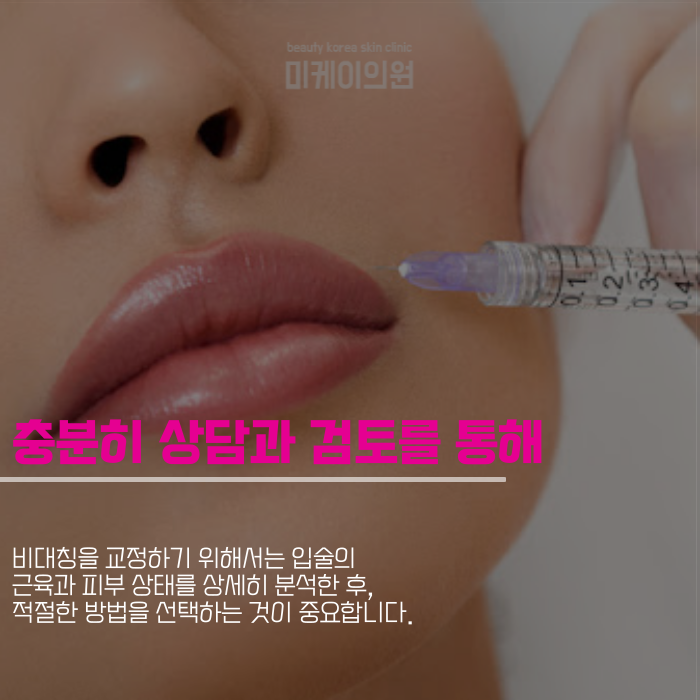 강남역 입꼬리필러로 매력적인 인상 만들기 관련 이미지 5