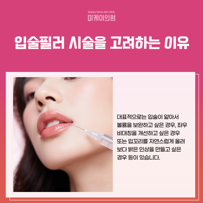 Where to Get Lip Fillers Near Gangnam Station: A Natural Design image 2