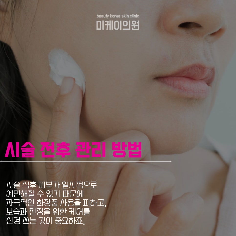 If You’re Searching for the Price of Shurink Lifting in Gangnam image 4