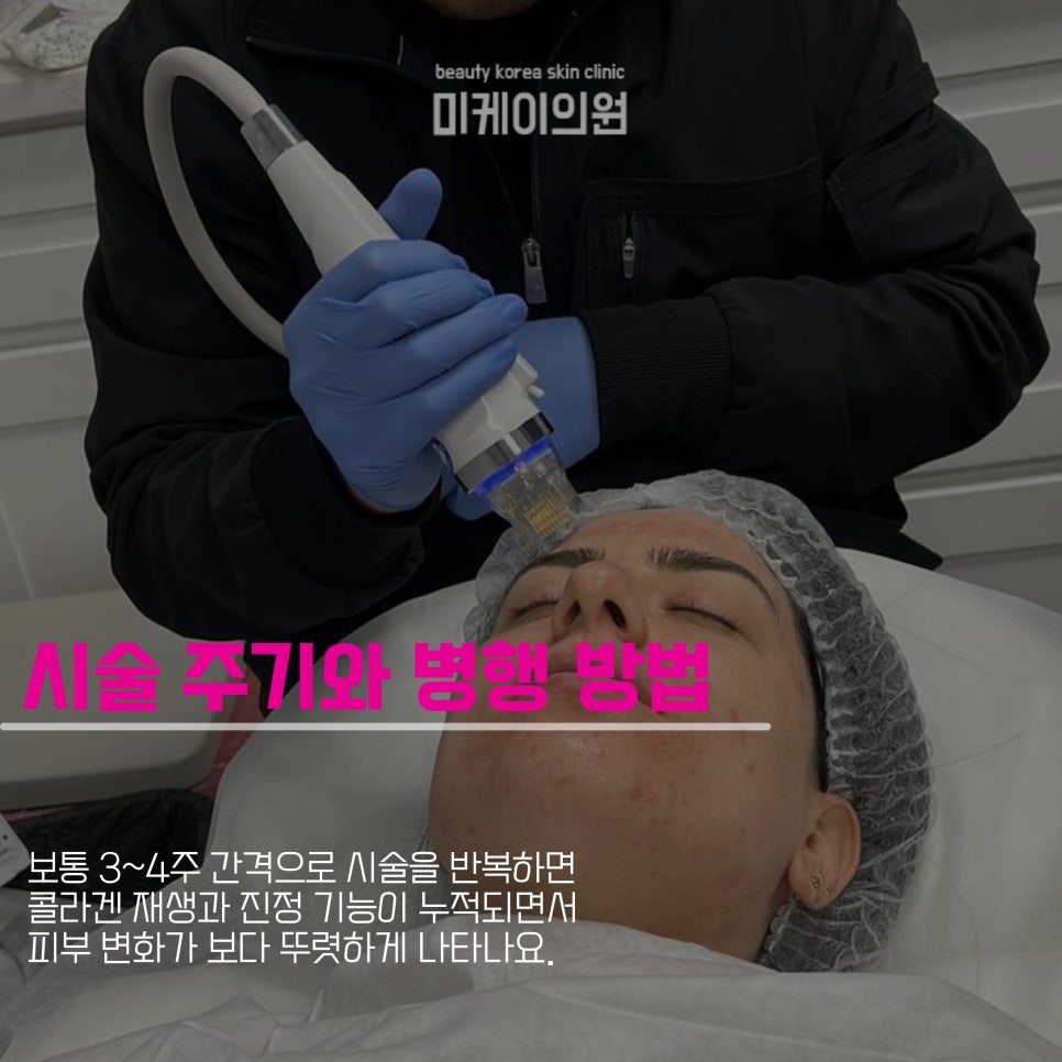 Potenza and LDM at a Gangnam Station Acne Dermatology Clinic image 4
