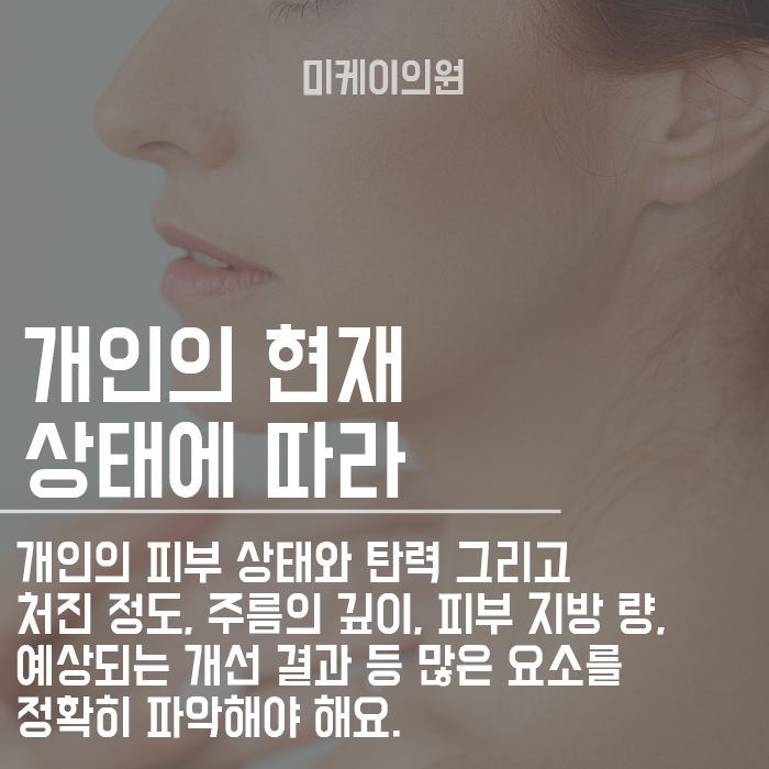 50대 실리프팅 할 수 있나요? 관련 이미지 3