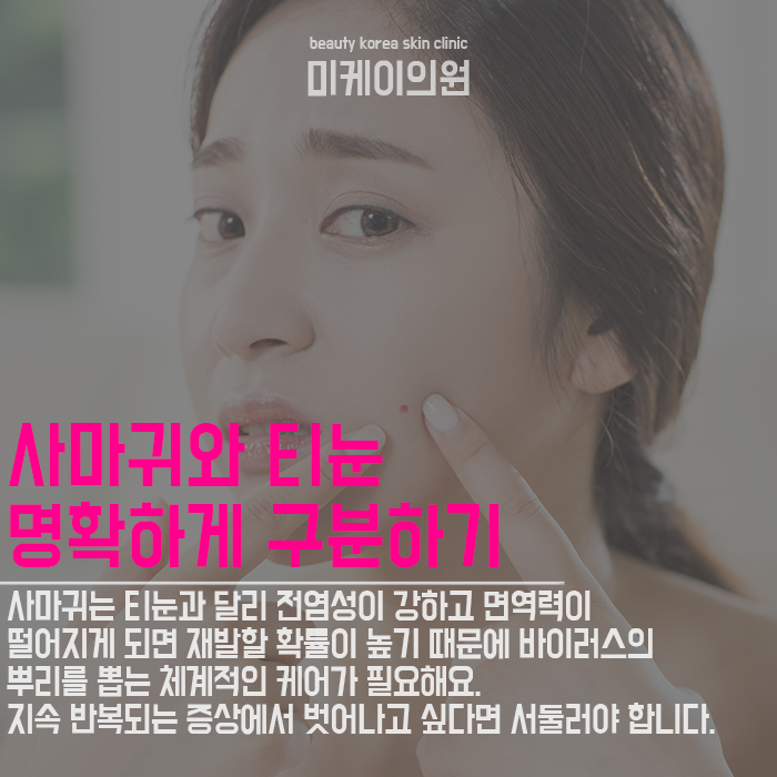 피부사마귀치료 사소한 증상도 무시할 수 없어요 관련 이미지 5