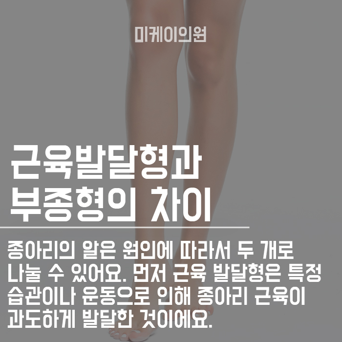 매끈한 다리 종아리 알 없애는 방법 관련 이미지 2
