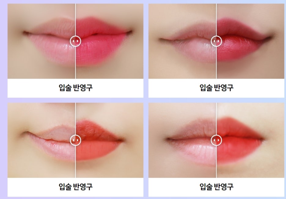 자연스러운 틴트입술반영구 미케이의원! 관련 이미지 5