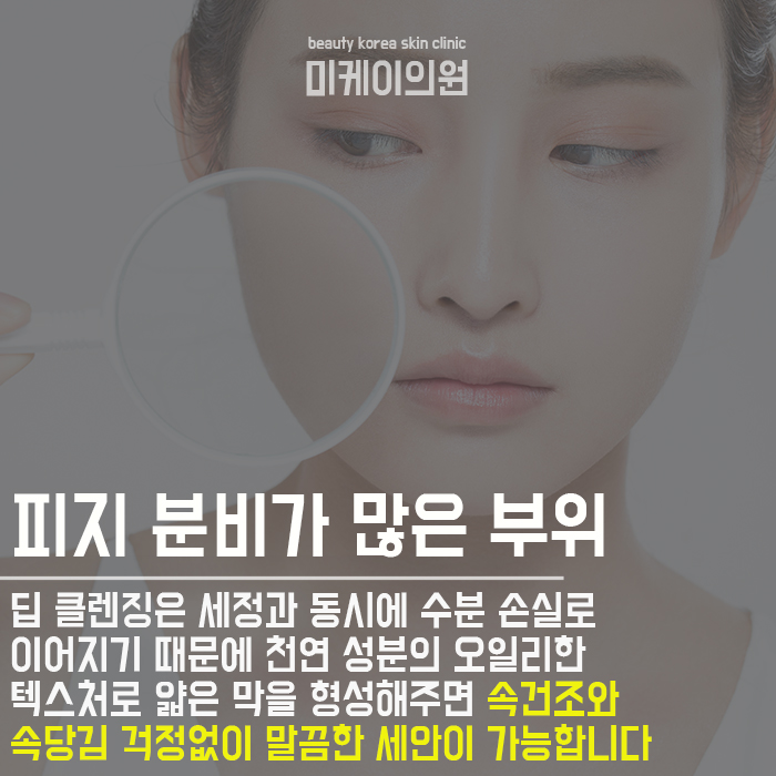 T존케어 복잡하지 않아요 관련 이미지 2