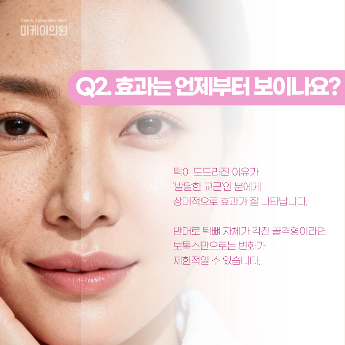 Gangnam Juvelook: What Is This Collagen Booster? image 3