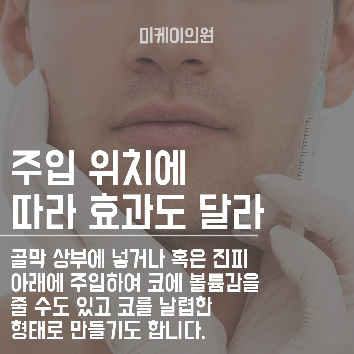 남자콧망울보톡스 갸름해지는 방법 관련 이미지 3