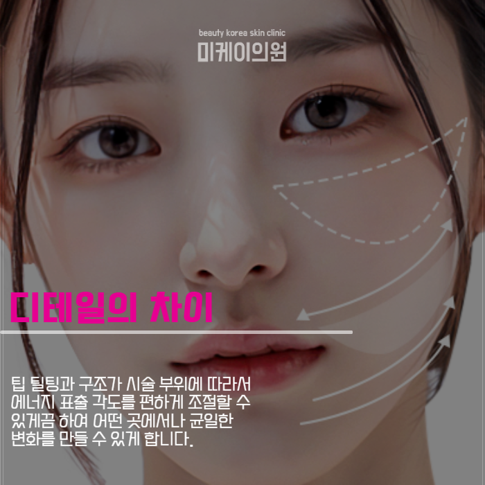 강남역 볼뉴머리프팅 주름 생각에서 해방 관련 이미지 3