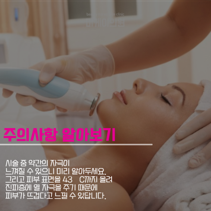 강남 인모드 이벤트 원하는 얼굴형 갖기 관련 이미지 5