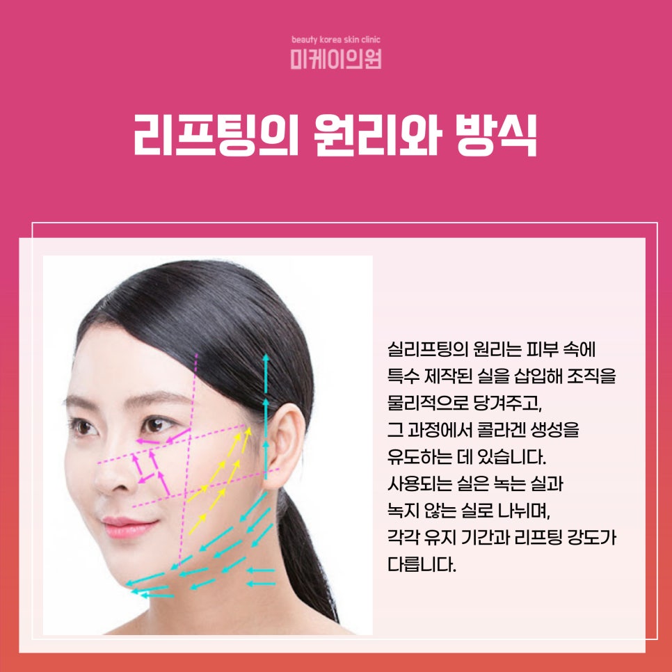 강남역 실리프팅 병원에서 탄력 있는 변화를 관련 이미지 2