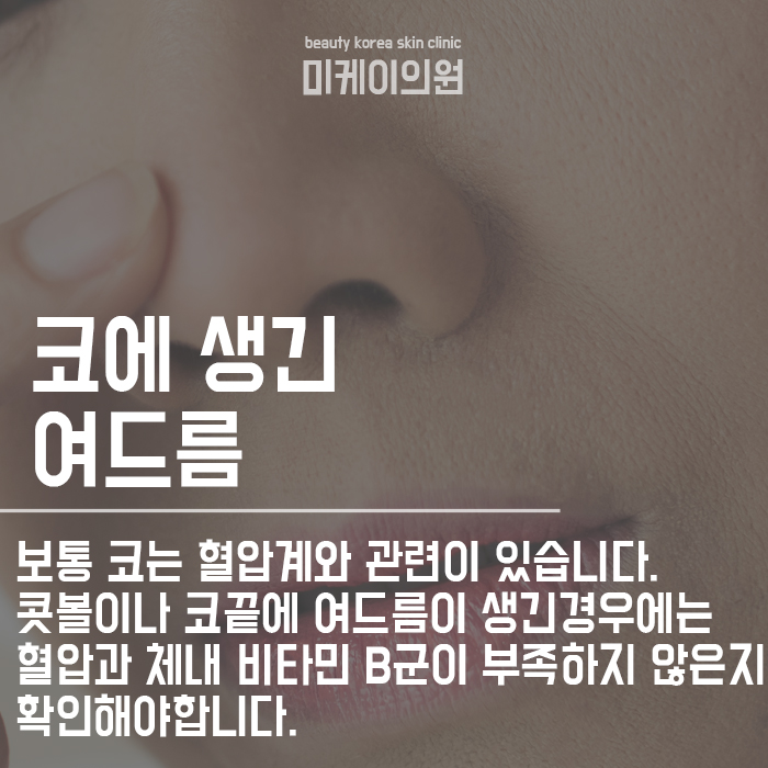 여드름 위치별 건강 상태 체크할 수 있어요! 관련 이미지 4