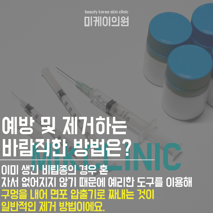 눈비립종원인 및 관리 방법 알아보자 관련 이미지 5