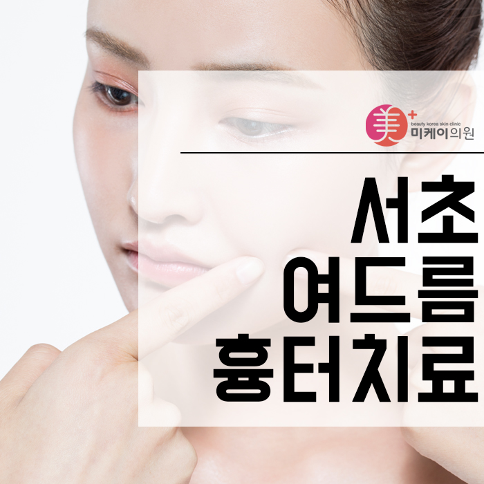 서초여드름흉터치료 변화가 눈에 보여요 관련 이미지 1