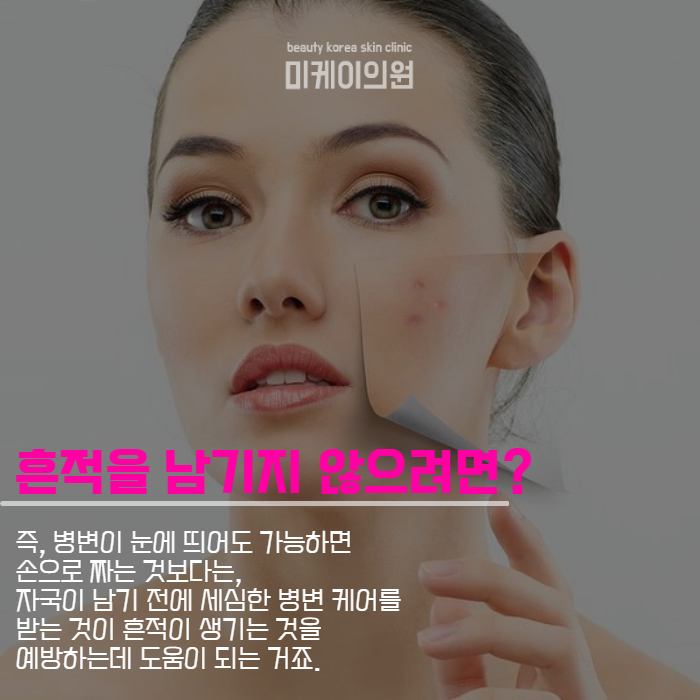 여드름자국치료 균일하고 매끄럽게 관련 이미지 4