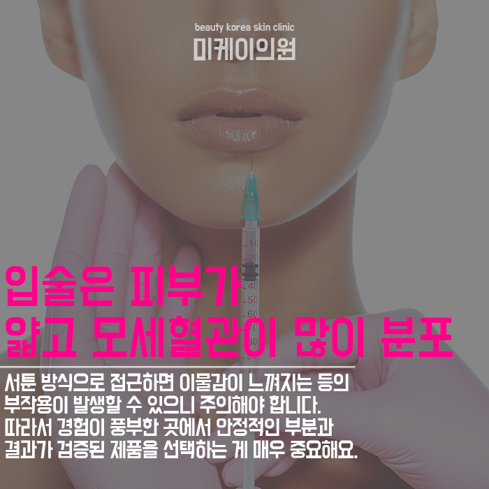 서초입술필러 볼륨감을 더해 콤플렉스까지 개선 관련 이미지 4