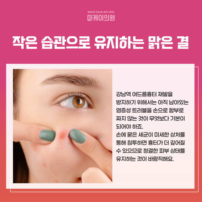 강남역 여드름흉터 매끈하게 채우는 법 관련 이미지 5