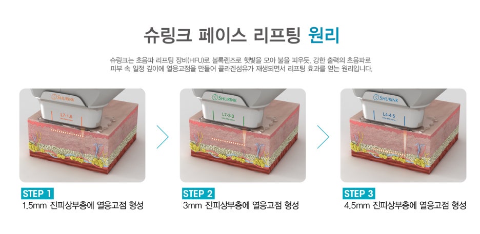 슈링크 원리 이제는 알아야 관련 이미지 6
