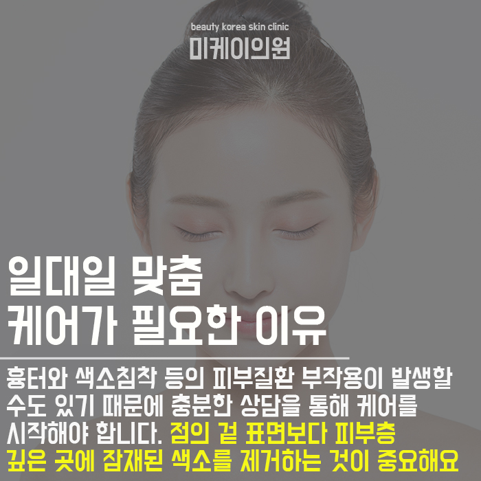 서초동점빼기 개인에 따라 제거방식이 달라 관련 이미지 3
