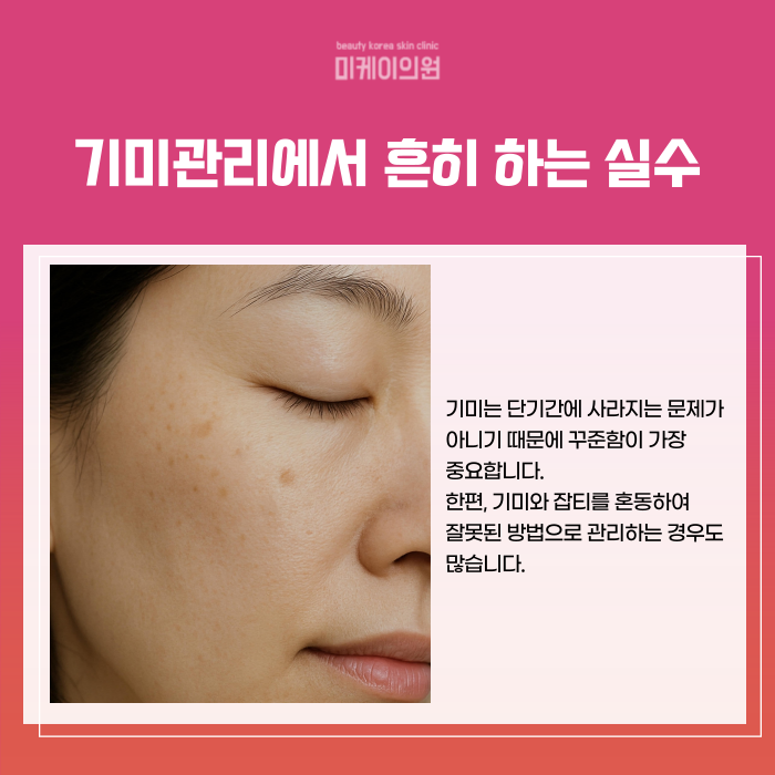 Can Melasma Be Removed in Just One Treatment at Gangnam Station? image 5