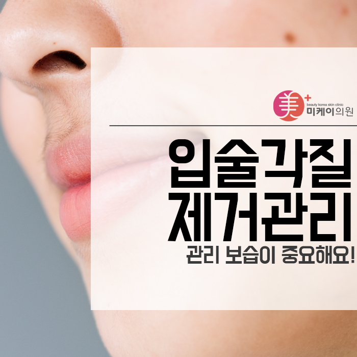 입술각질제거관리 후 관리 보습이 중요해요! 관련 이미지 1
