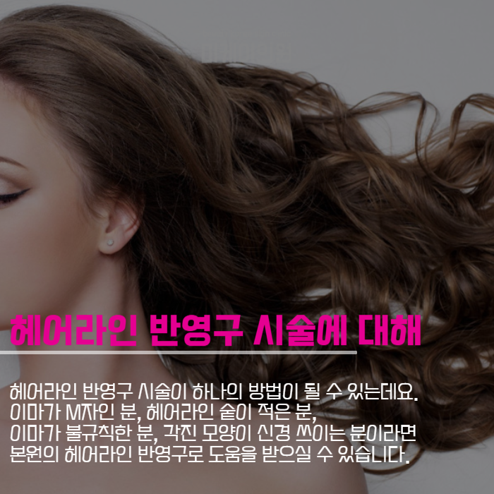 탈모커버하는방법 모발이식부터 반영구까지 관련 이미지 5
