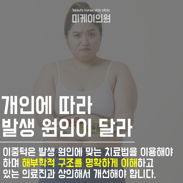 이중턱 원인 이제는 알아야 관련 이미지 3