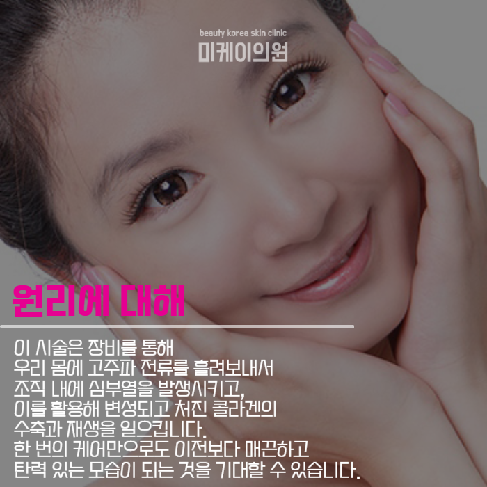 강남 올리지오 효과 QnA까지 관련 이미지 3