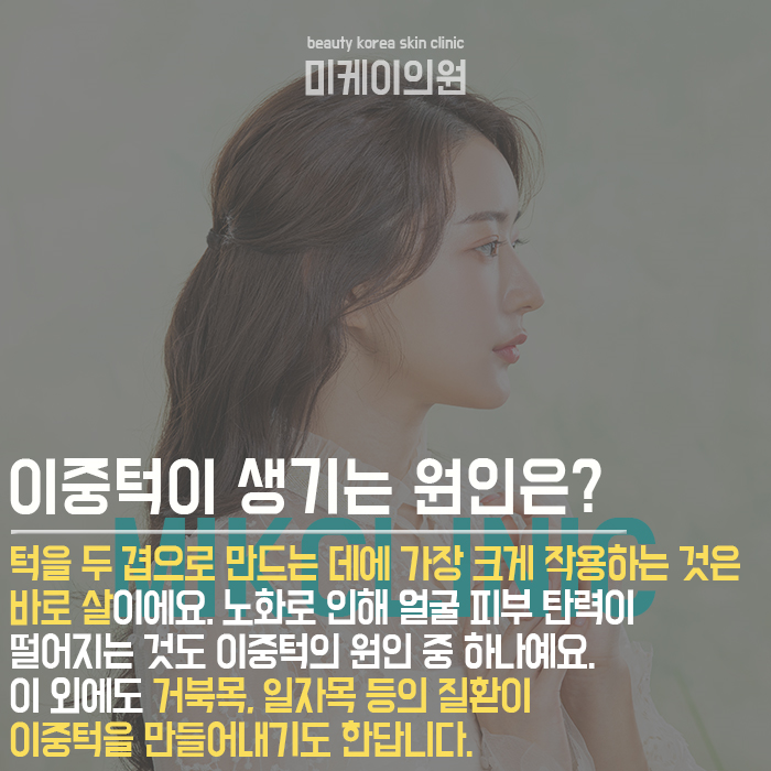 이중턱없애는방법 이렇게 하면 도움 된다! 관련 이미지 2