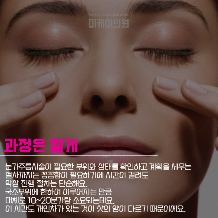 눈가주름시술 아이슈링크로 해결하세요 관련 이미지 5