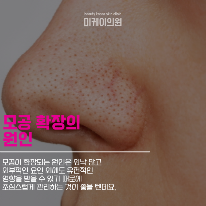 강남모공치료 깨끗하고 자신있는 얼굴 관련 이미지 3