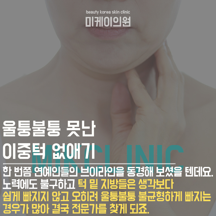서초이중턱슈링크 날렵한 얼굴라인 만들기 관련 이미지 2