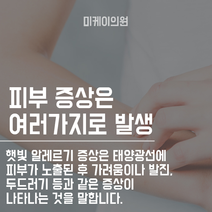 햇빛 알레르기 증상 왜 나타나는 것일까? 관련 이미지 2