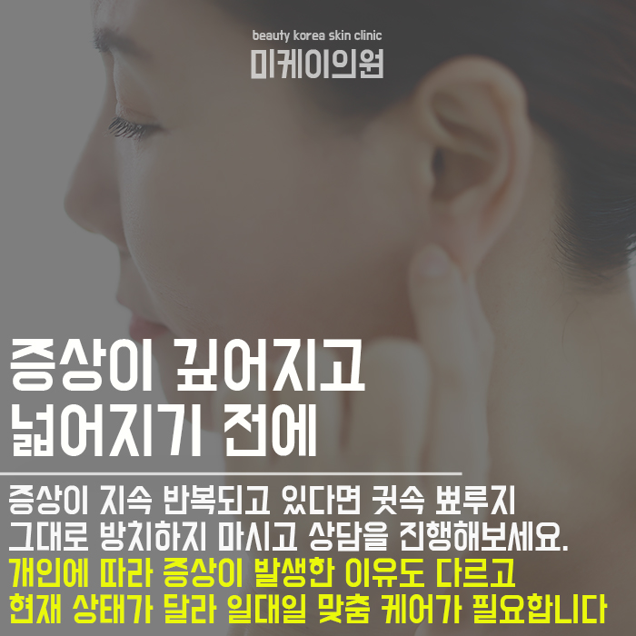 귓속 뾰루지 방치하지 마세요 관련 이미지 4