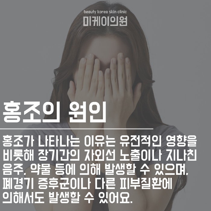 홍조가 나타나는 이유와 관리방법 관련 이미지 3