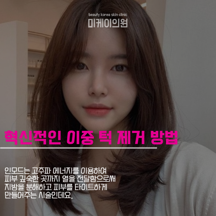 투턱없애기 인모드와 윤곽 주사로 관련 이미지 2