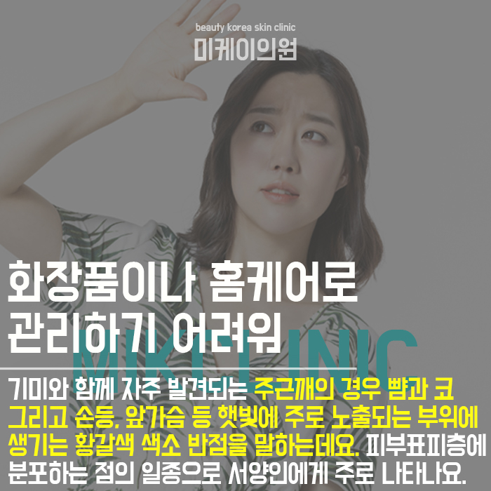 색소침착레이저토닝 변화가 눈에 보여요 관련 이미지 2