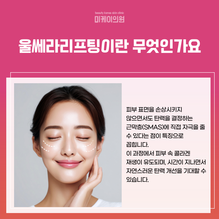 Principles of Ultherapy Lifting at Seocho Station and Selection Criteria image 2