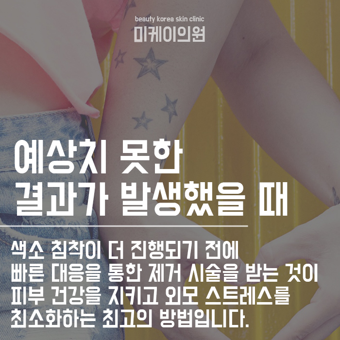 강남문신제거 최고의 실력으로 확실하게 보장합니다! 관련 이미지 4