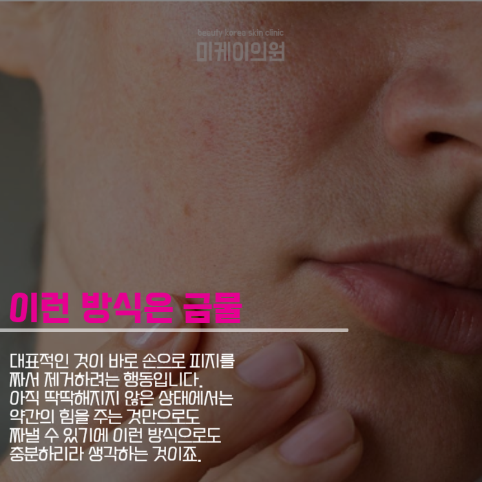 모공청소하는방법 여름이니까 꼭 알아두기 관련 이미지 5