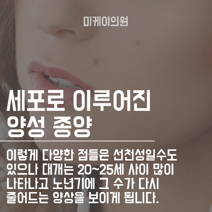 얼굴 점 위치에 따른 관상 보는 방법에 대하여 관련 이미지 2