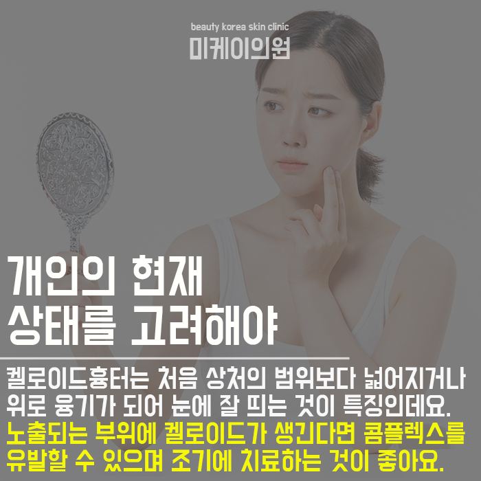 켈로이드흉터관리방법 어렵지 않아요 관련 이미지 2