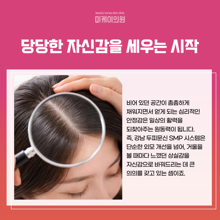 강남 두피문신 SMP 정수리와 이마 고민 관련 이미지 5