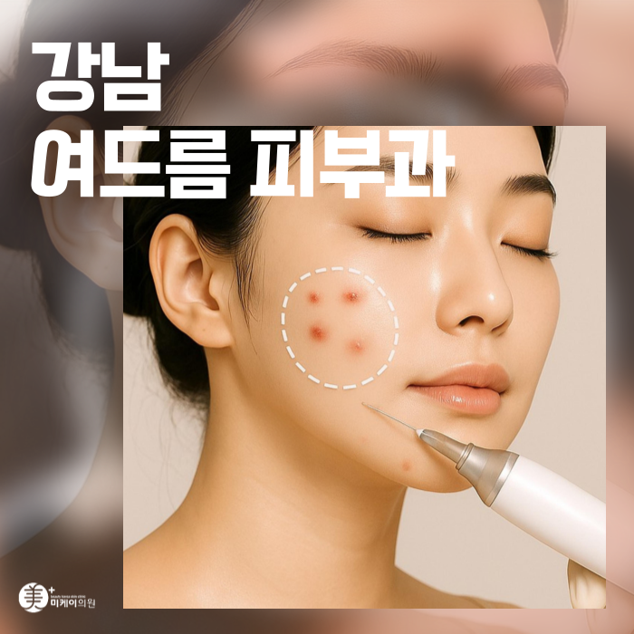 강남 여드름 피부과 잘하는곳 흉터 개선하고 싶다면 관련 이미지 1