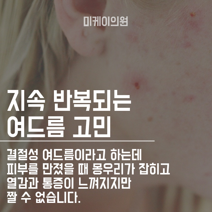 역삼염증여드름주사 미케이의원 통해서 관리하자~ 관련 이미지 2