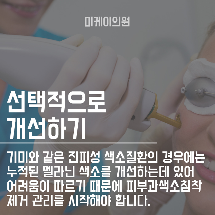 피부과색소침착 제거 밝고 화사하게 개선하고 싶다면 관련 이미지 3