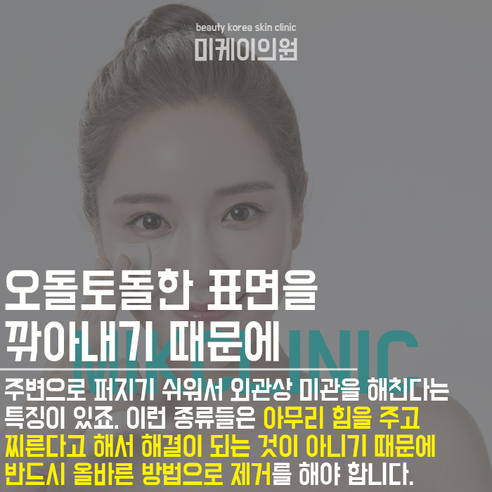 CO2레이저효과 매끈한 피부결 완성 관련 이미지 2