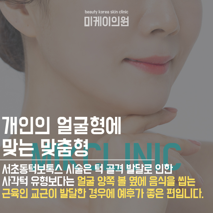서초동턱보톡스 개인의 얼굴형에 맞는 맞춤형 시술을 통해 관련 이미지 2