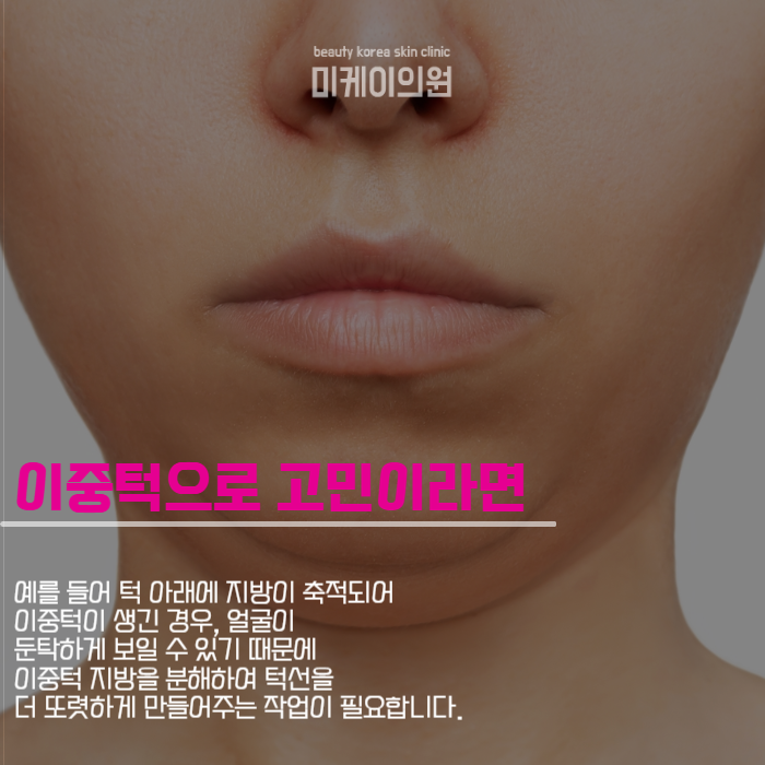 강남역 윤곽주사 자연스럽게 잘 하는 곳 관련 이미지 2