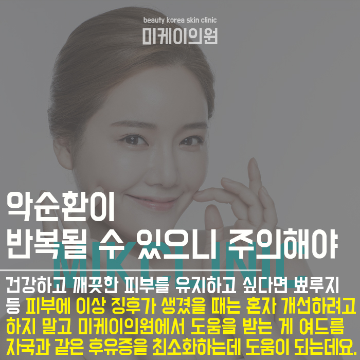 여드름관리하는방법 개인마다 다를 수 있어 관련 이미지 6