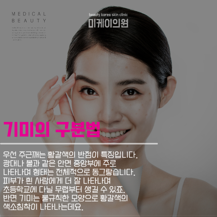 강남기미치료 맑은 피부를 찾아 관련 이미지 2